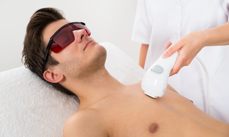 How to Get Laser Hair Removal Covered by Insurance