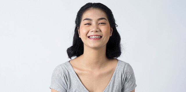 How Much to Remove Braces without Insurance